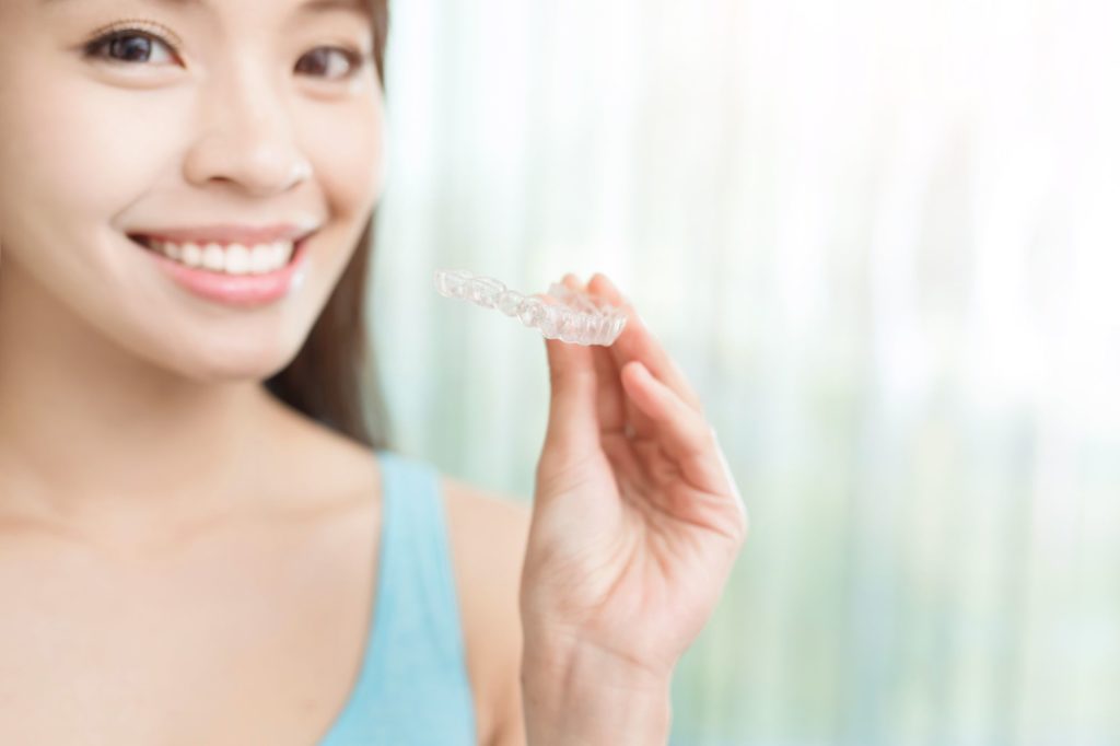 Marion Clear Aligners