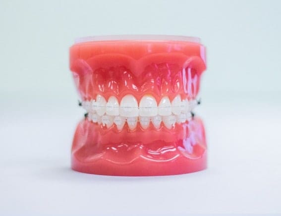 Clear ceramic braces for a discreet orthodontic treatment in New Braunfels TX